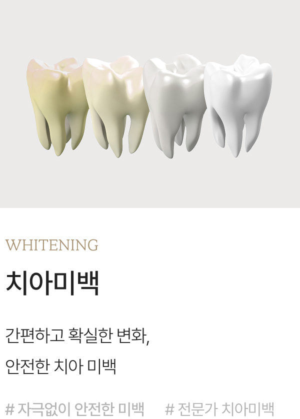 치아미백