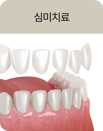 심미치료